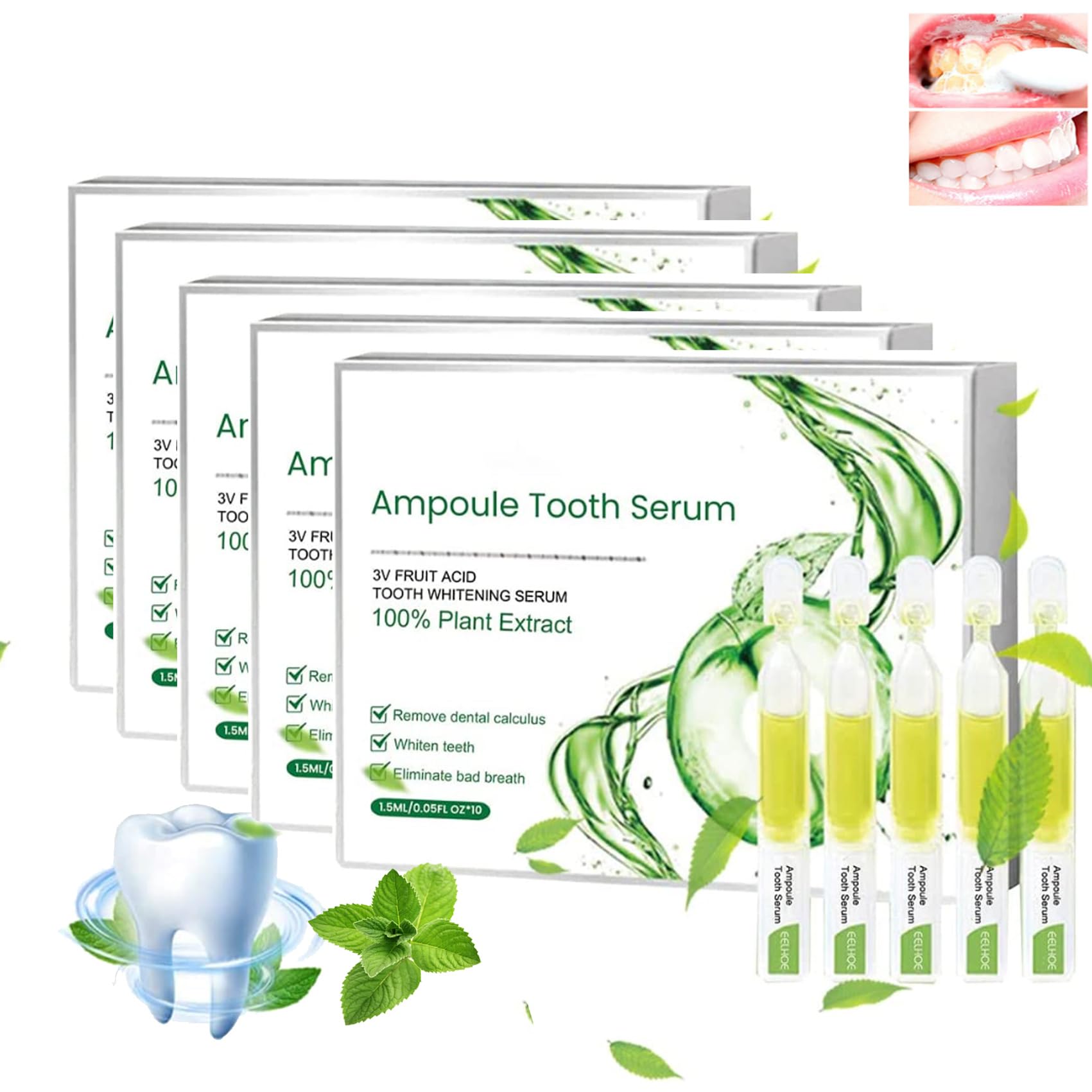 Tolpa Ampullen Zahnpasta - TLOPA Ampoule Tooth Serum, Ampullen-Essenz-Zahnpasta, 3-V-Fruchtsäure-Zahnaufhellungsessenz, Entfernung von Zahnstein und Plaque,einfach zu verwenden (5box/50pcs)