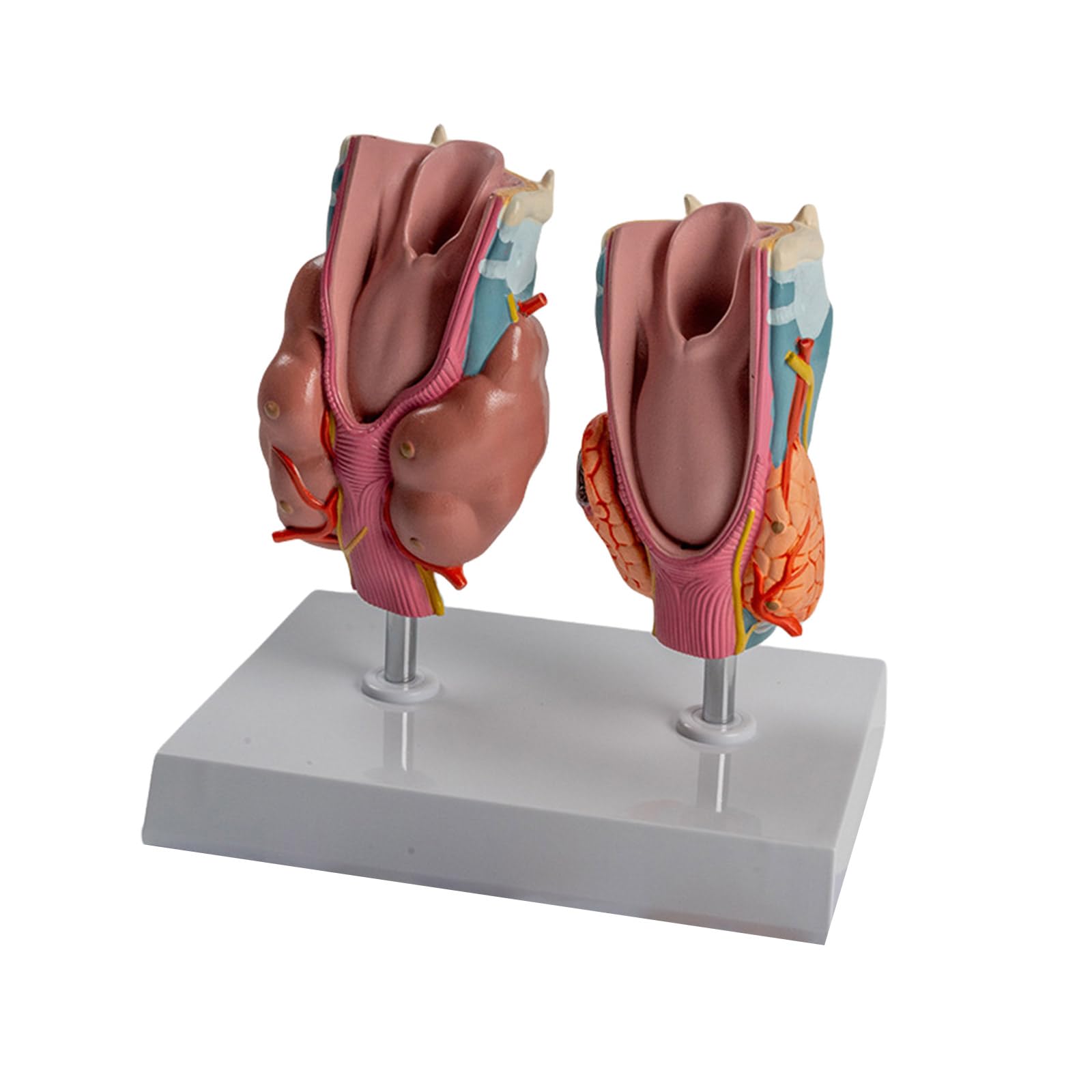 Anatomisches pathologisches Schilddrüsenmodell mit abnehmbarem Teil, pathologisches Schilddrüsen-Klarynx-Anatomie-Modell für pädagogische Nutzung