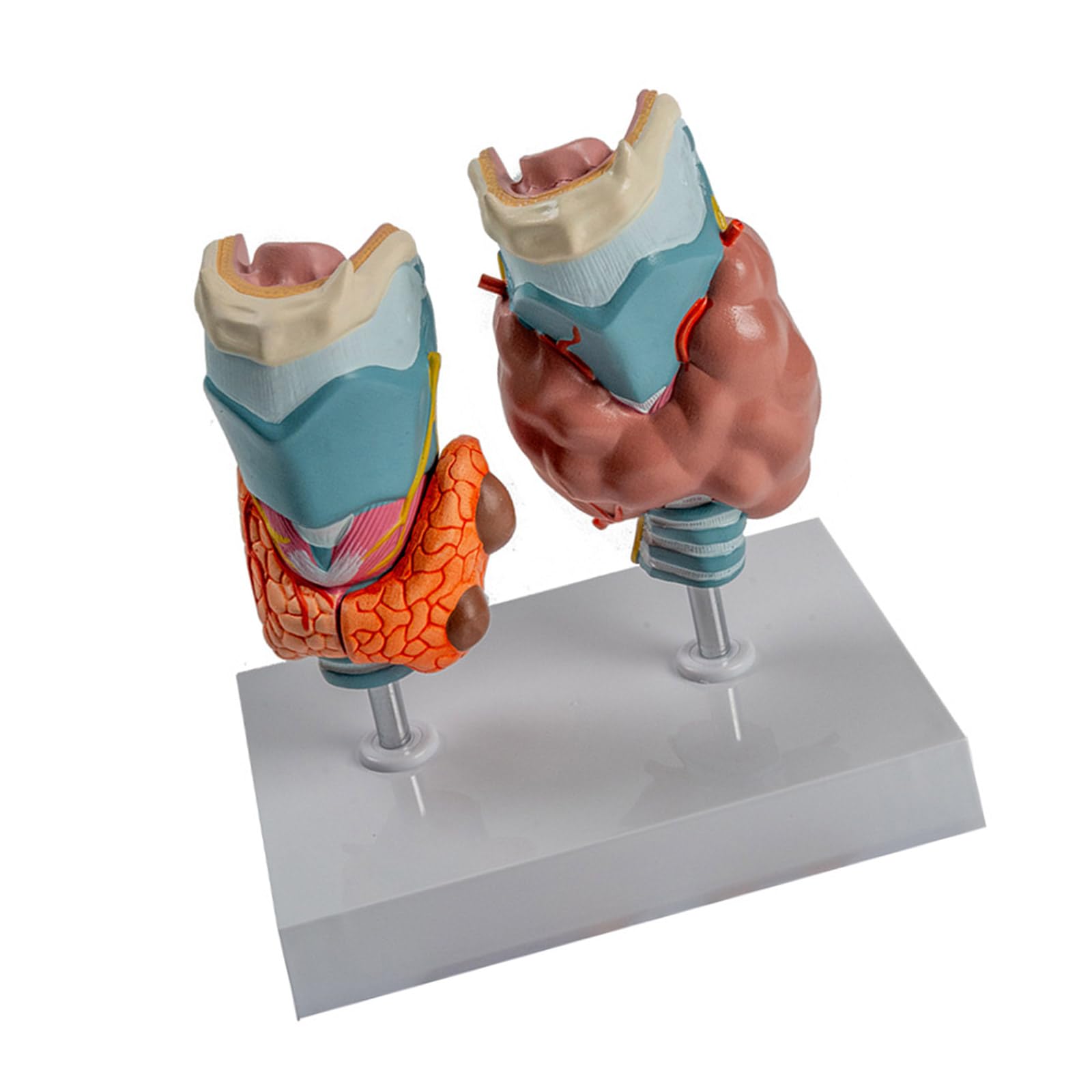 Pathologische Schilddrüsen-Anatomie-Modell für Studenten, Ärzte, anatomisches pathologisches Schilddrüsenmodell, Klassenzimmer-Unterricht