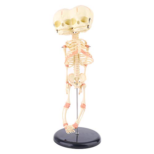 Human Baby Deformed for Head Skull Research Model Skelett Anatomical Anatomy Teaching Display