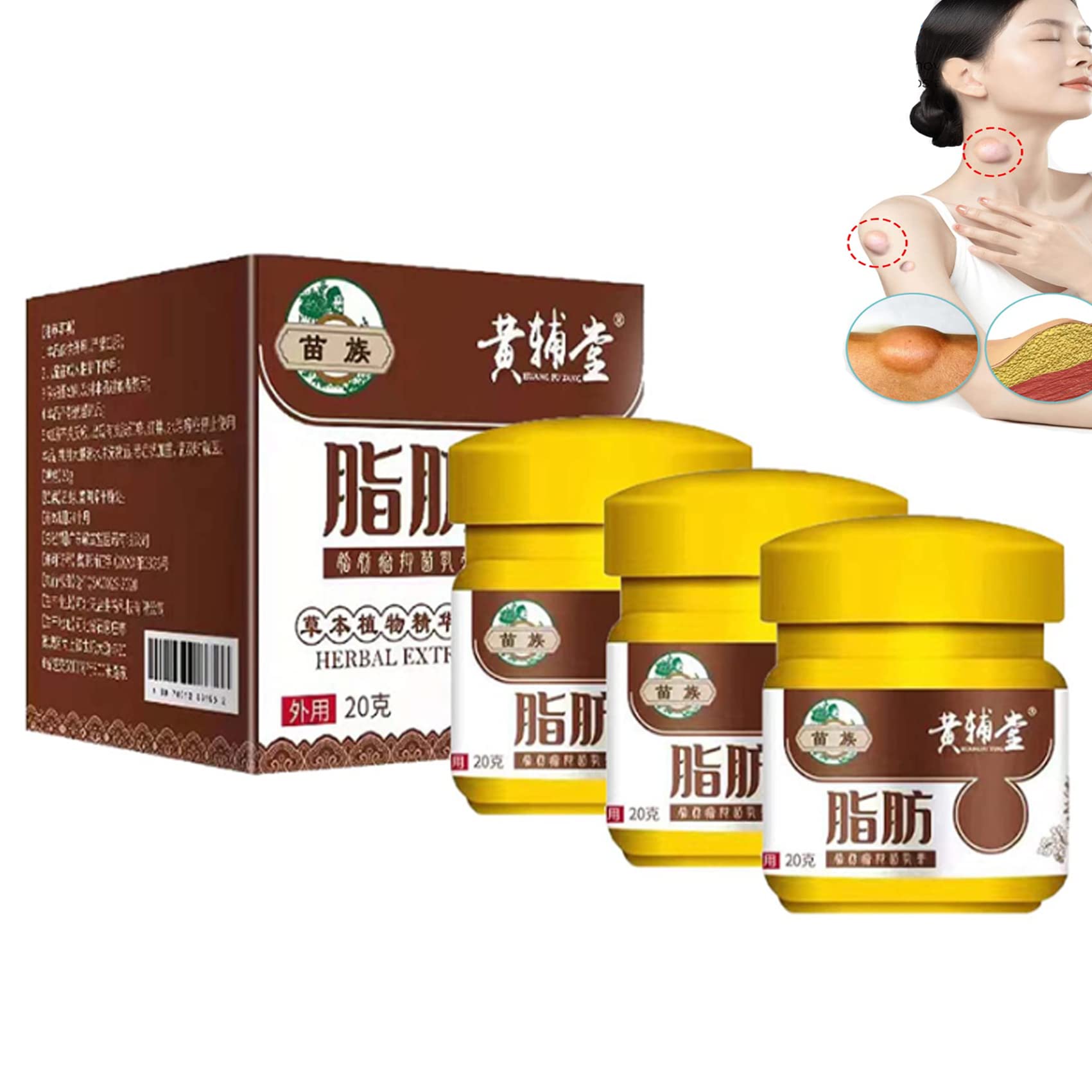 Lipoma Removal Cream, Huangfutang Lipoma Removal Cream, Lumpfree Lipoma Removal Cream, Natural Herbal Lipoma Lumps Removal Cream, Get Rid of Your Fatty Lipoma Lumps (60g)